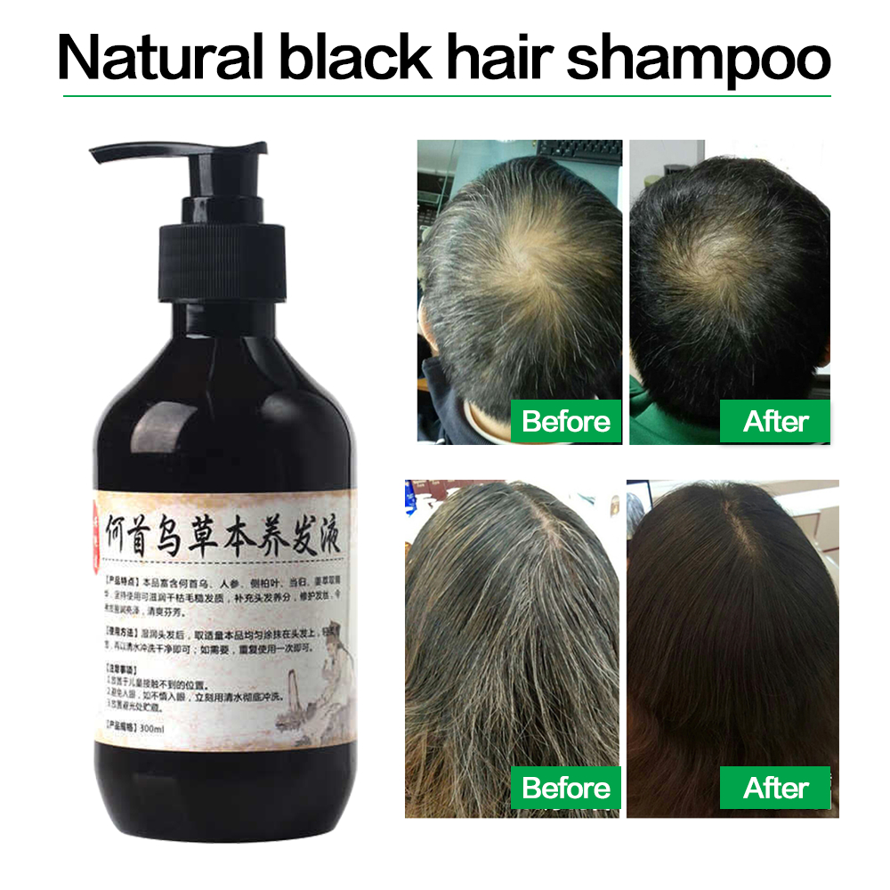 Herbal Natural Polygonum Multi - Hair Care Herbal incelemesi ve fiyatı