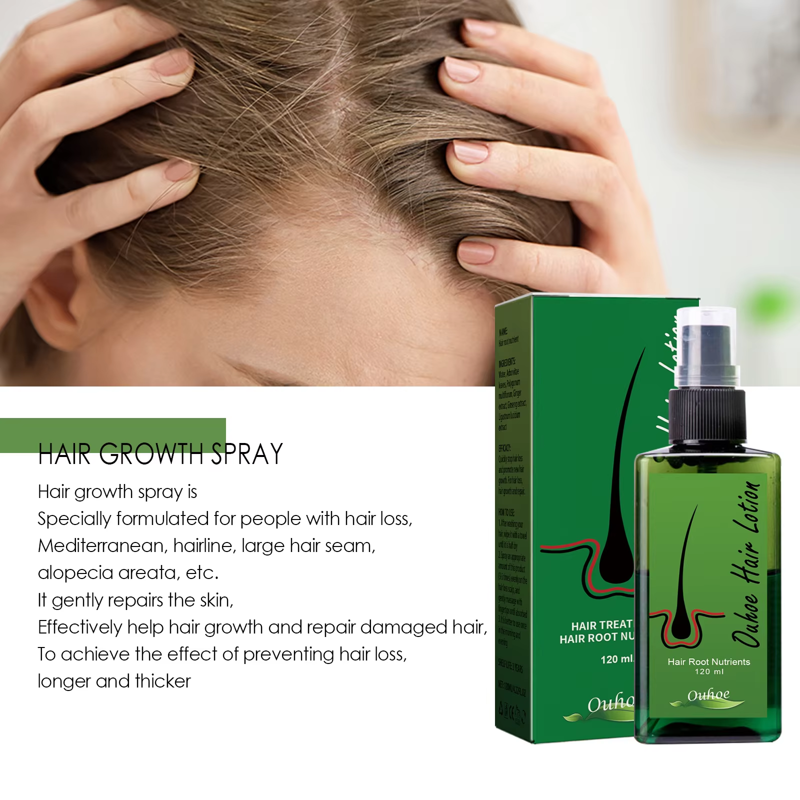 Hair Growth Spray Anti Hair Lo - Hair Care Herbal incelemesi ve fiyatı