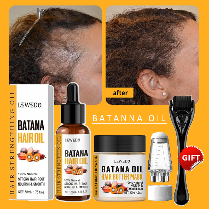 Batana Oil Hair Growth Kit Tra - Hair Care Dupes incelemesi ve fiyatı