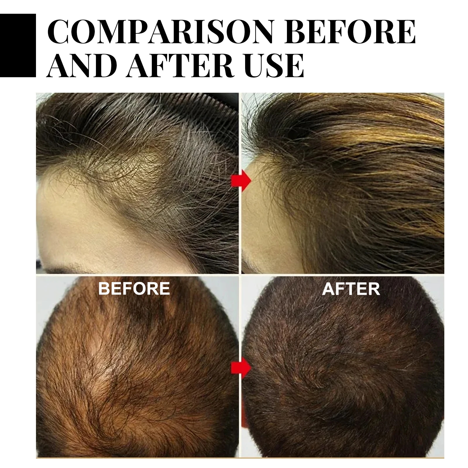 Ginger Hair Growth spray Anti  - Hair Care Herbal incelemesi ve fiyatı