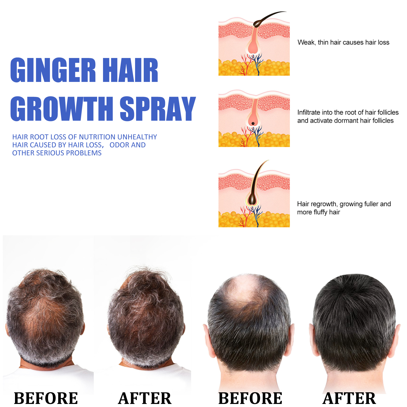 Ginger Hair Growth spray Anti  - Hair Care Herbal incelemesi ve fiyatı