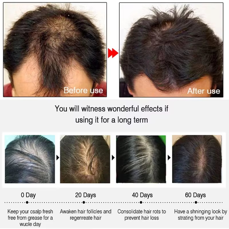 Ginger Hair Growth spray Anti  - Hair Care Herbal incelemesi ve fiyatı