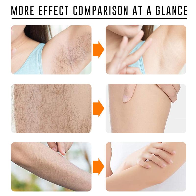 Fast Hair Removal Spray Painle - Hair Care Women incelemesi ve fiyatı